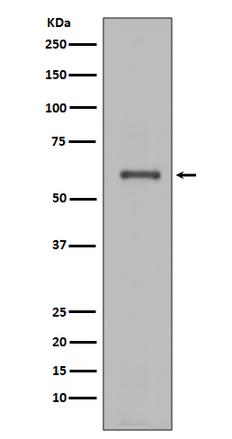 WB - Anti-NOX4 Rabbit Monoclonal Antibody ABO13341